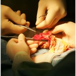 operacia