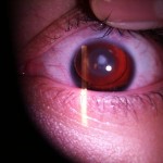 oftalmologia
