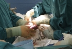 transplantacia pecene3