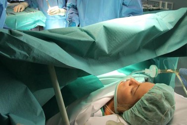 transplantacia obliciek
