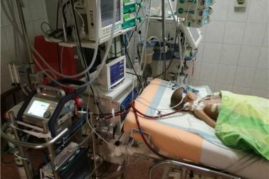 ecmo1