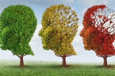 alzheimer1