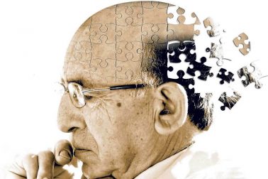 alzheimer2