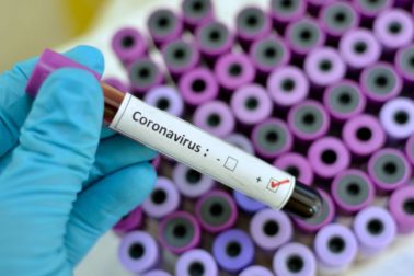 coronavirus
