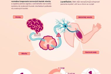 SMA_Infografika_Biogen-page-001