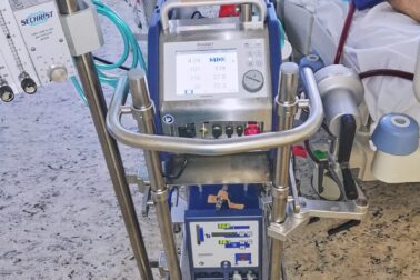 ECMO_ARO_2a