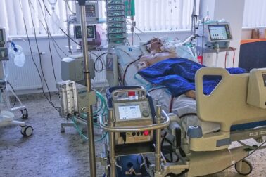 ECMO_ARO_3a