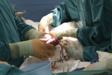 transplantacia pecene1