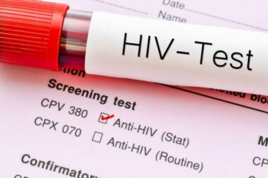 HIV test