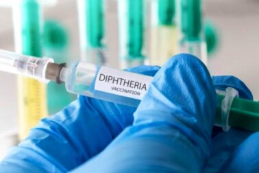 difteria - zaskrt