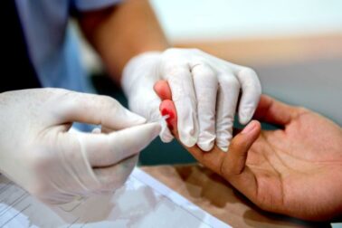 hiv test1