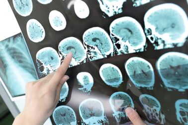 neurologia2