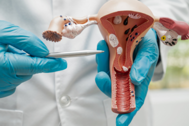 HPV