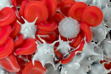 leukemia1
