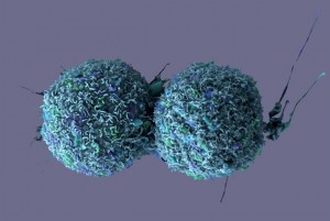 kultivovane bunky rakoviny pluc