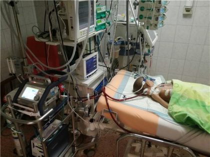 ecmo1