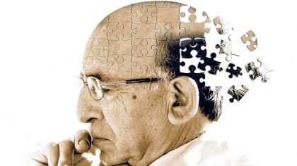 alzheimer2