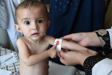 AFG.NUTRITION.Kishem.22.08.2019.UNICEF.FrankDejongh.4425