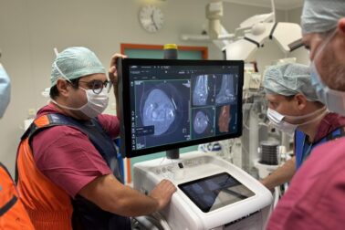 3D operacia1